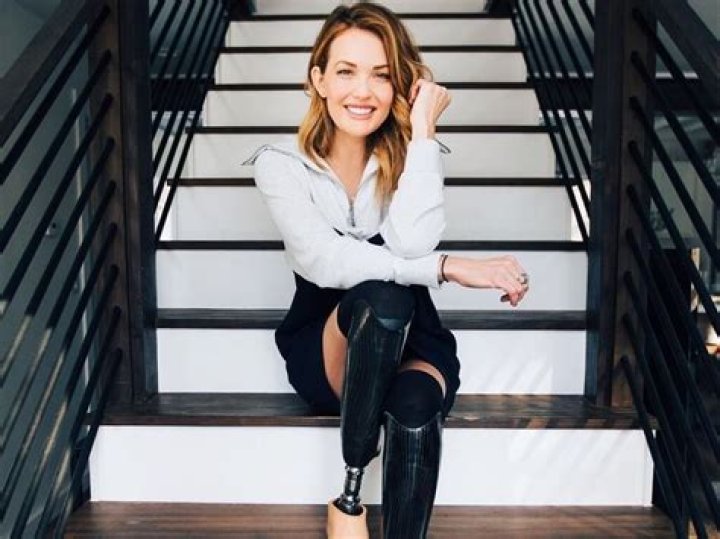 Amy Purdy Biography, Age, Height, Husband, Net Worth, Family